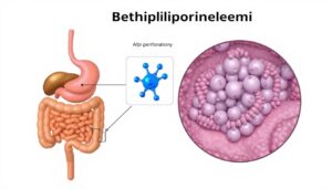 Memahami Penyakit Abetalipoproteinemia: Gejala dan Penanganan